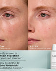 MEDIK8 Total Moisture Daily Cleansing Gel (145ml)
