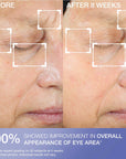 STRIVECTIN Eye Concentrate For Wrinkles (30ml)