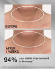 STRIVECTIN Tighten & Lift Advanced Neck Cream PLUS with Alpha-3 Peptides (50ml)