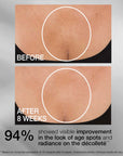 STRIVECTIN Tighten & Lift Advanced Neck Cream PLUS with Alpha-3 Peptides (50ml)