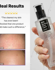 COSRX Pleťová Esencia Proti Čiernym Bodkám BHA (100ml)
