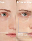 AESTURA Atobarrier 365 Hydro Cera-Ha Serum (30ml)