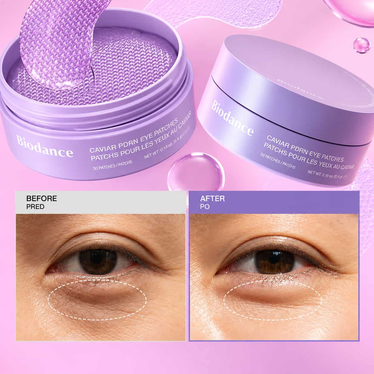 BIODANCE Caviar PDRN Eye Patches (30ea)