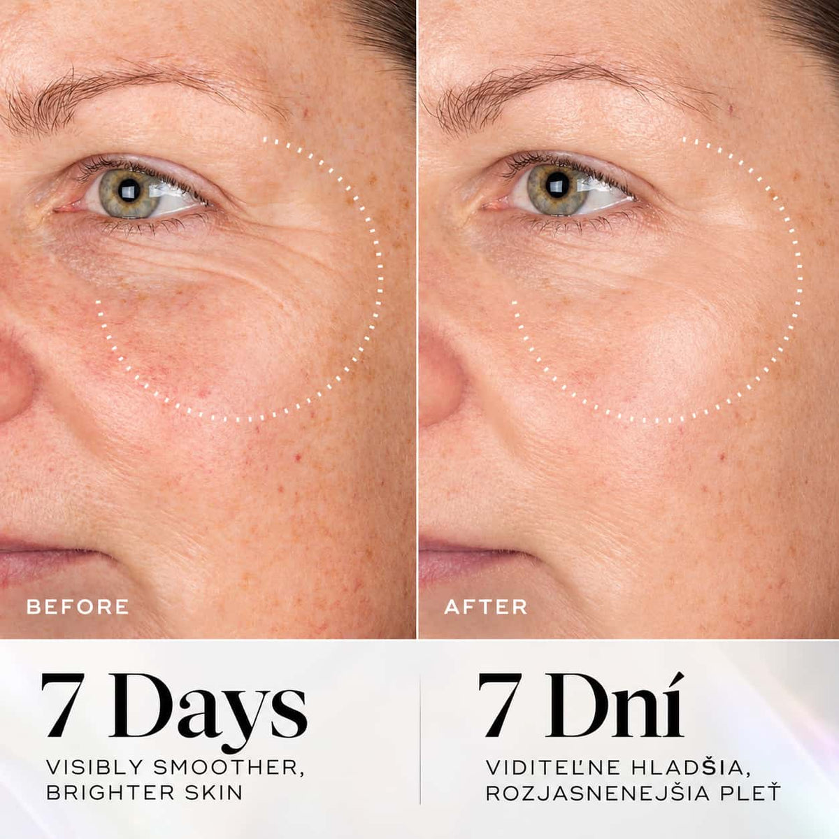 MEDIK8 Exo-PDRN Prismatic+ Advanced Rejuvenating Serum (30ml)