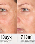 MEDIK8 Exo-PDRN Prismatic+ Advanced Rejuvenating Serum (30ml)