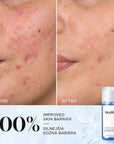 MEDIK8 Press & Clear – Exfoliating 2% BHA Toner (150ml)