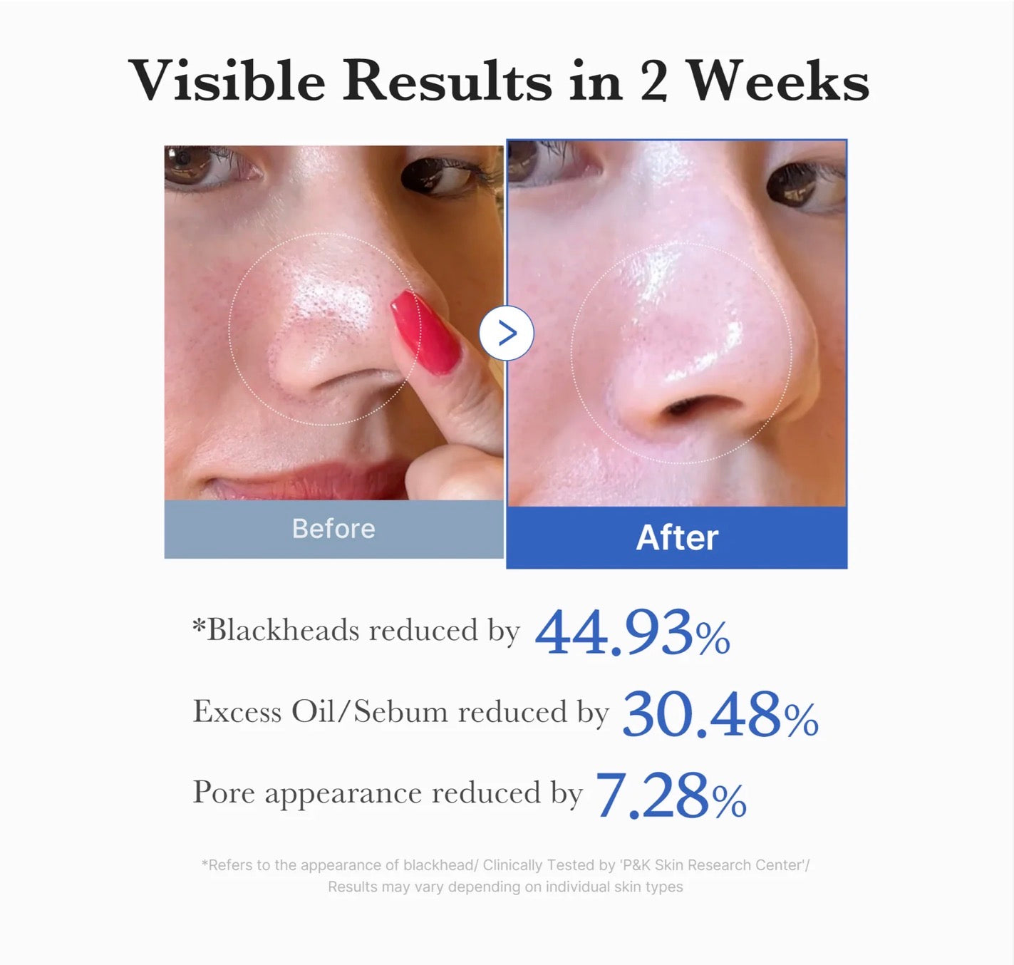 MEDICUBE Zero Pore Exfoliačné Tampóny 2.0 70ks