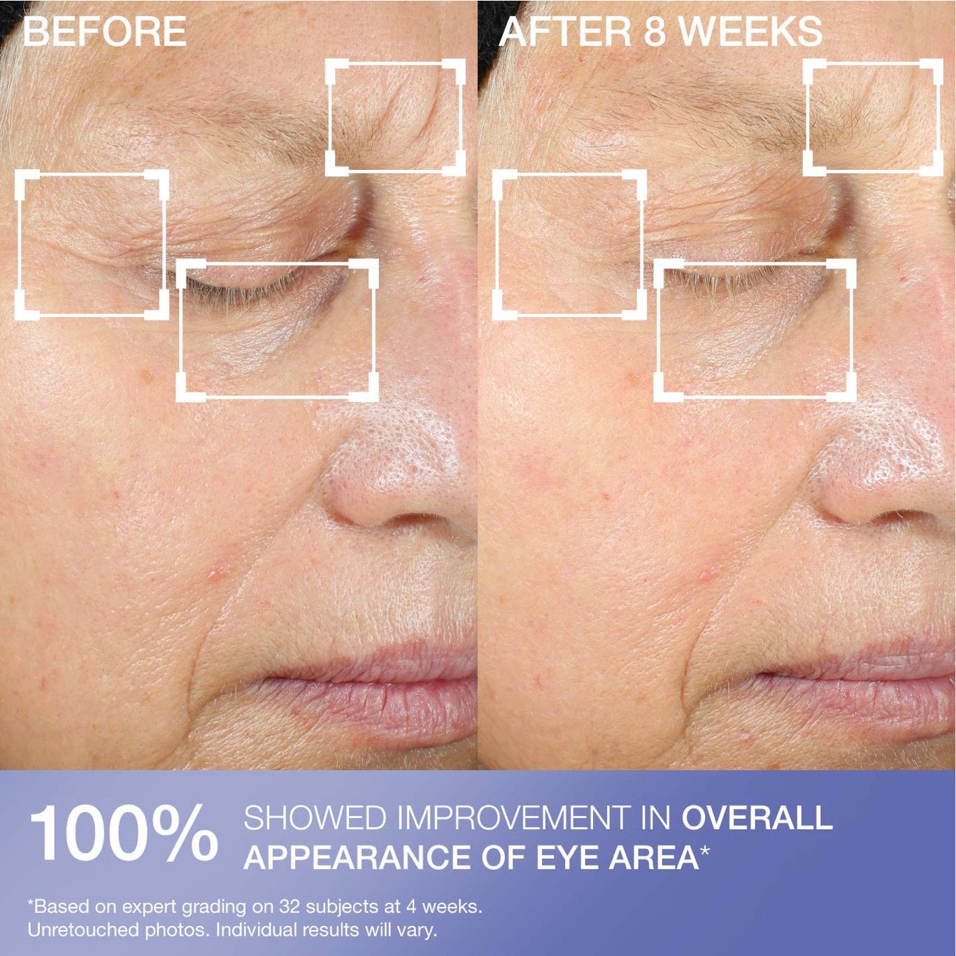 STRIVECTIN Eye Concentrate For Wrinkles (30ml)