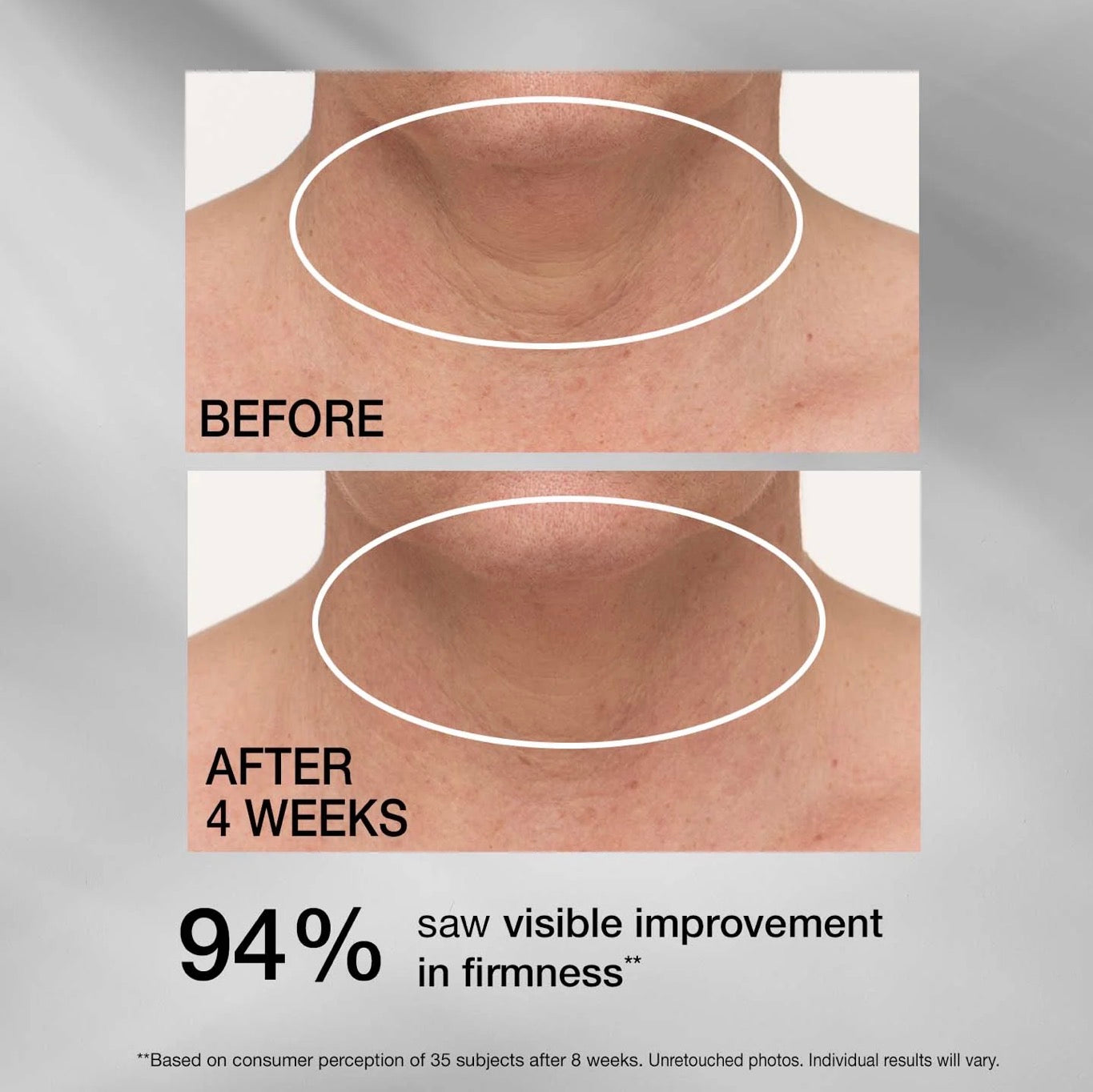 STRIVECTIN Tighten &amp; Lift Advanced Neck Cream PLUS with Alpha-3 Peptides (50ml)