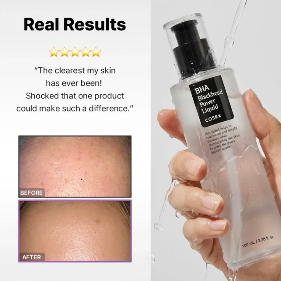COSRX BHA Blackhead Power Liquid (100ml)