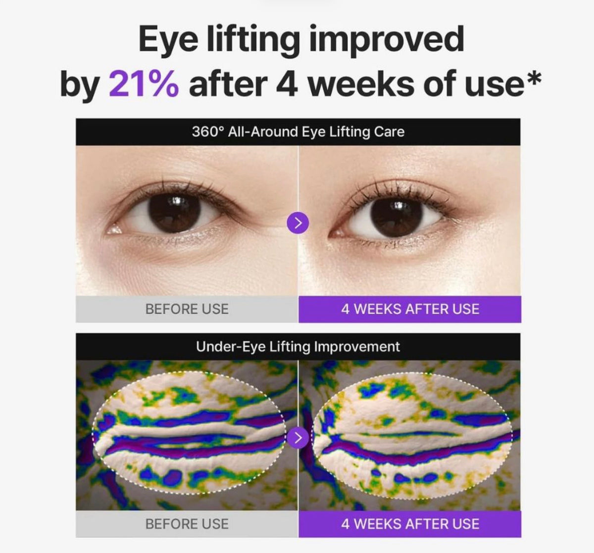 CENTELLIAN24 360º Shot PDRN Lifting Eye Cream (30ml)