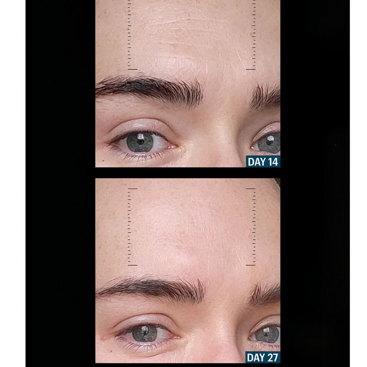 ALLIES OF SKIN Multi Peptides &amp; GF Advanced Lifting Serum (30ml)