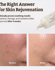 DR.REJU-ALL Advanced PDRN Rejuvenating Cream (20ml)